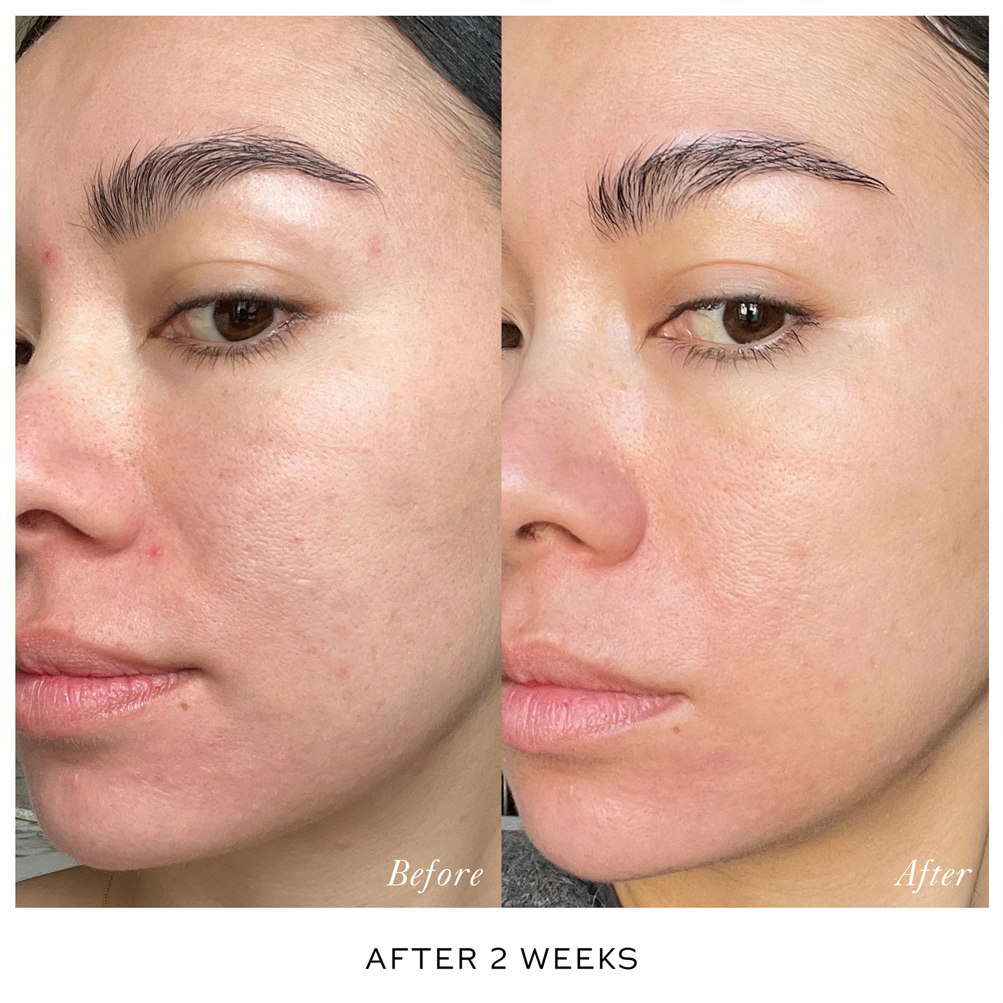 Skin Activator