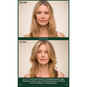 Invati Ultra Advanced Serum 150 ml