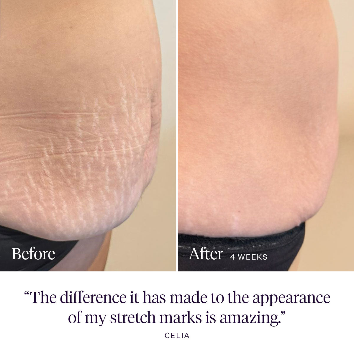 Daydreamer Body Serum