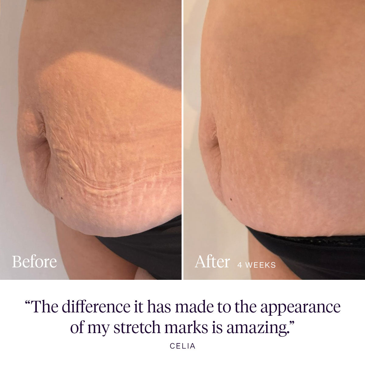 Daydreamer Body Serum