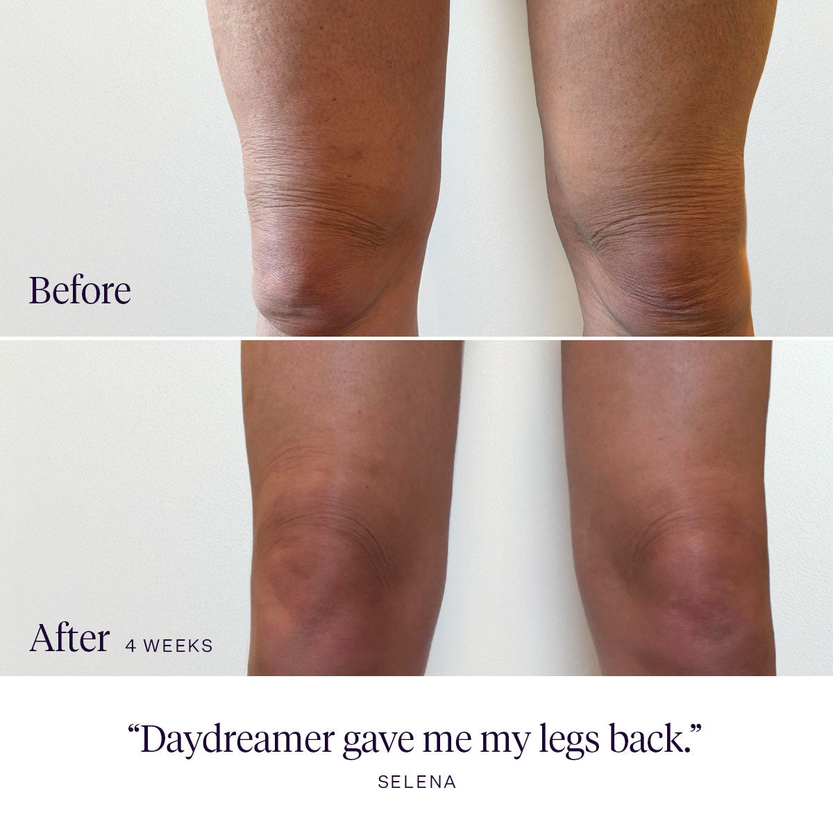 Daydreamer Body Serum