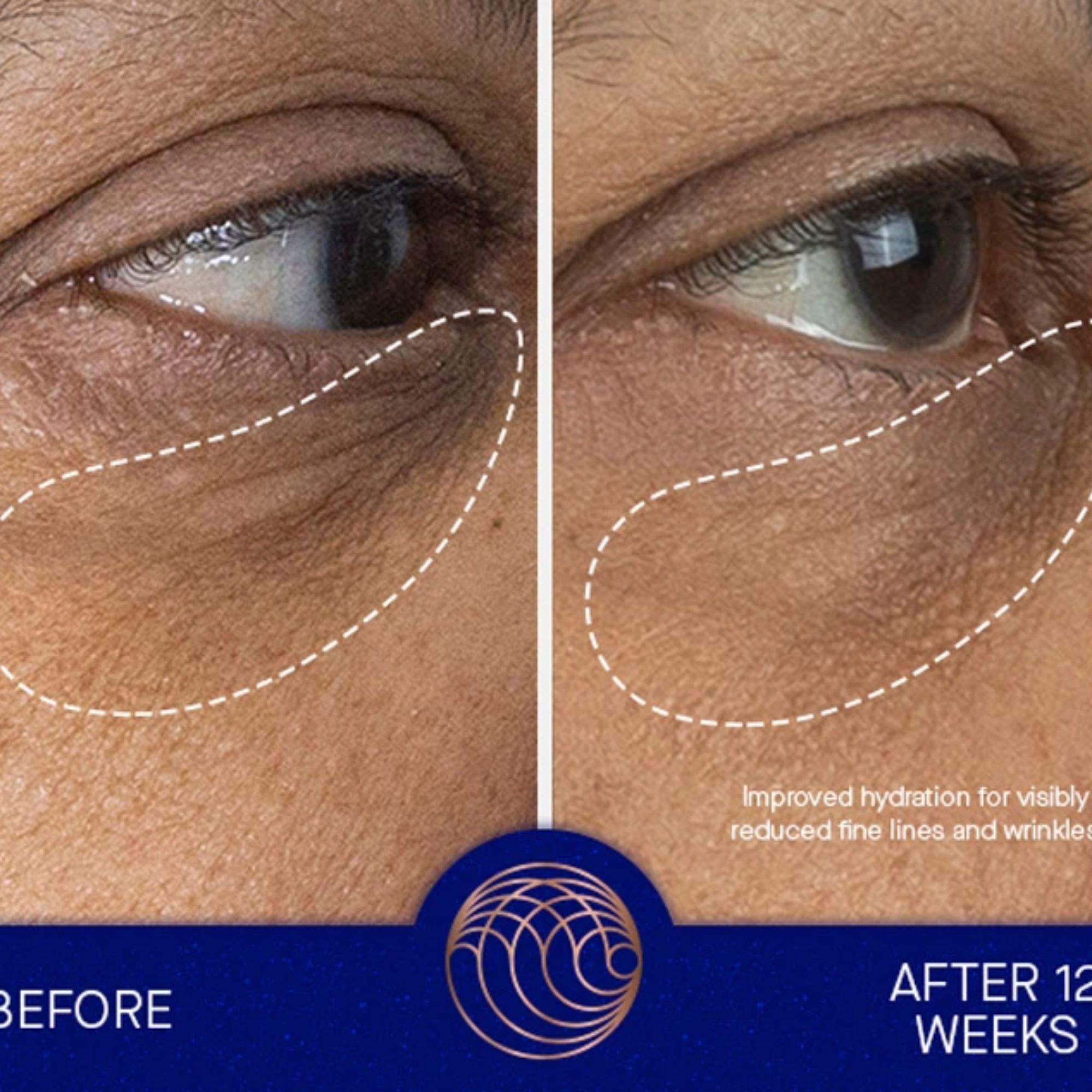 The Eye Cream Nomad 15 ml