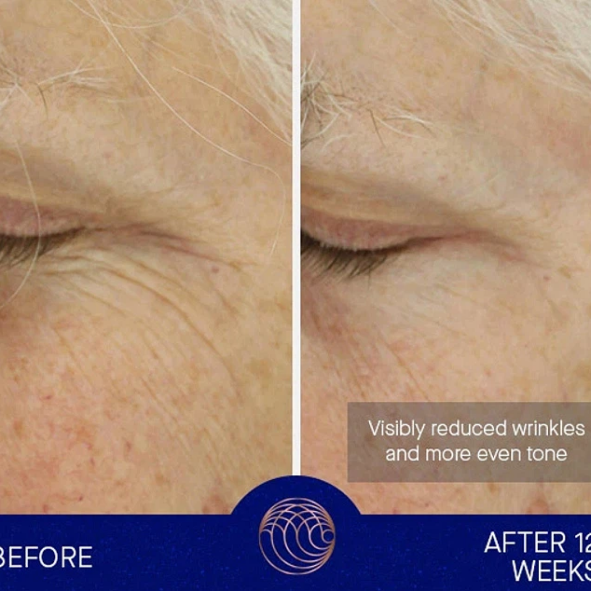 The Light Cream 30 ml