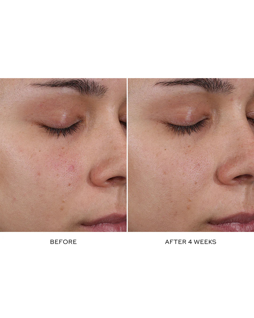 Pore Refining Complex