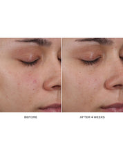 Pore Refining Complex